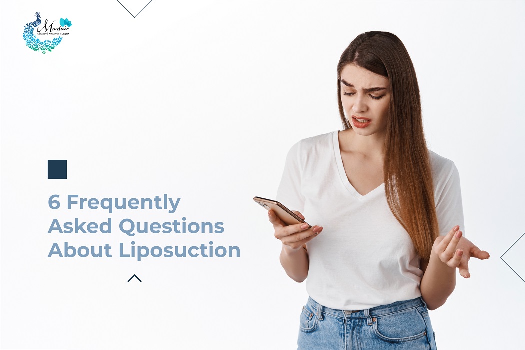 6 Frequently Asked Questions About Liposuction