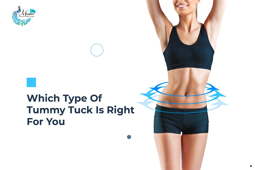 Which Type Of Tummy Tuck Is Right For You