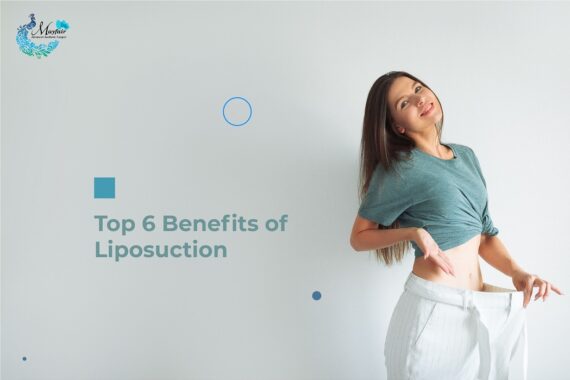 Top 6 Benefits of Liposuction