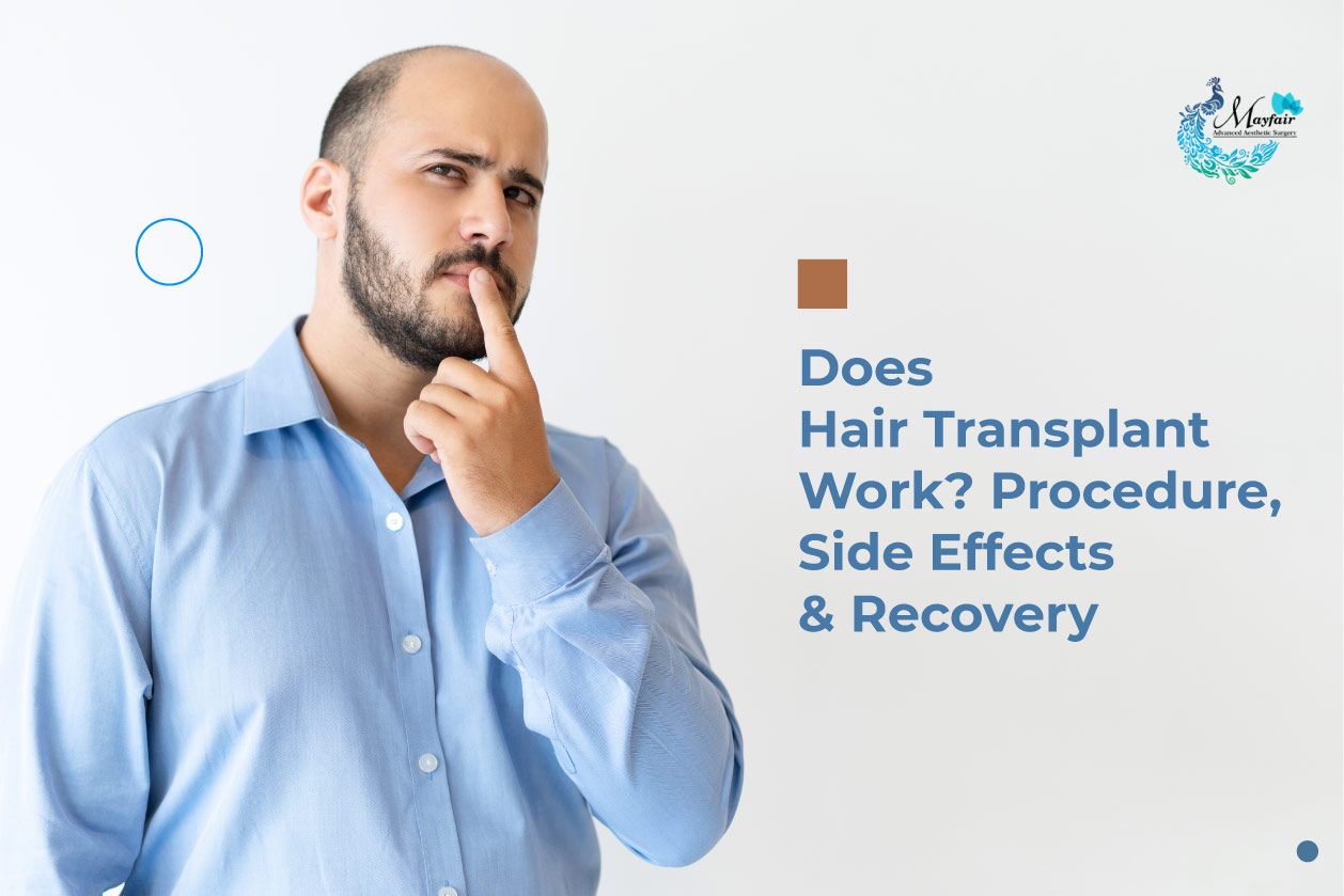 Does Hair Transplant Work? Procedure, Side Effects, And Recovery
